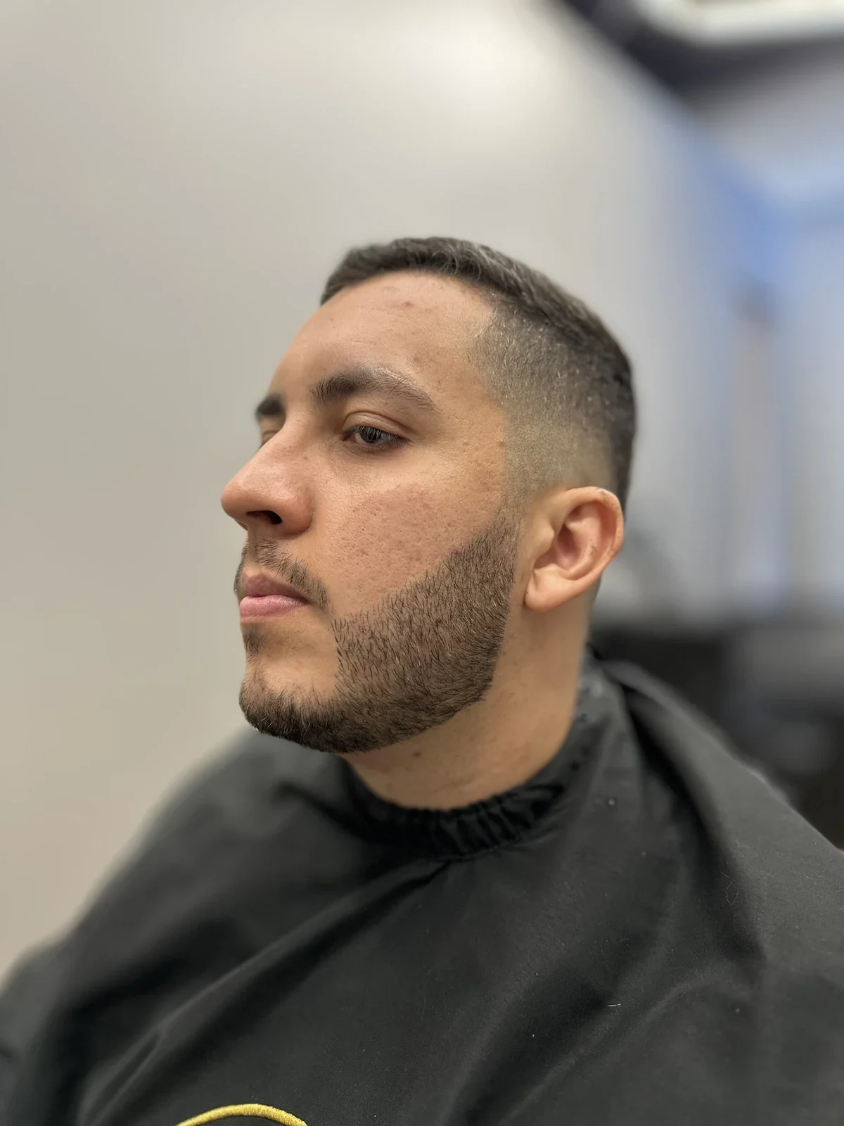 Depois da micropigmentação de barba