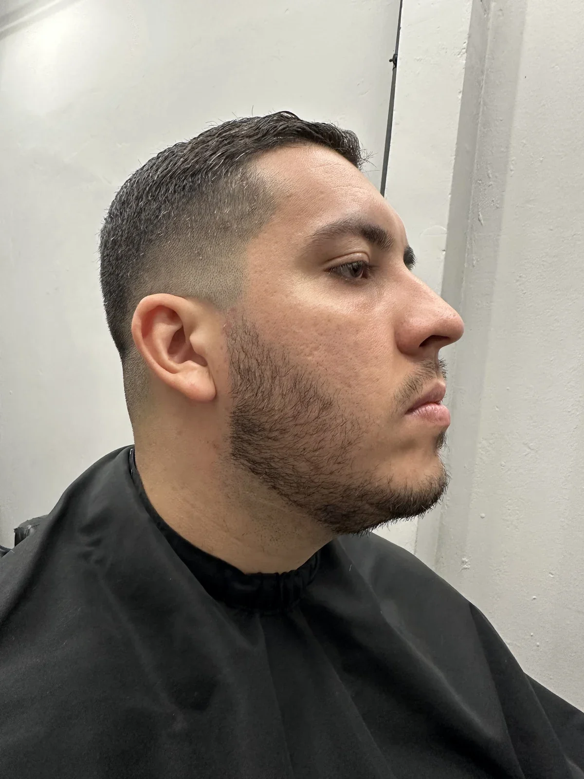 Antes da micropigmentação de barba