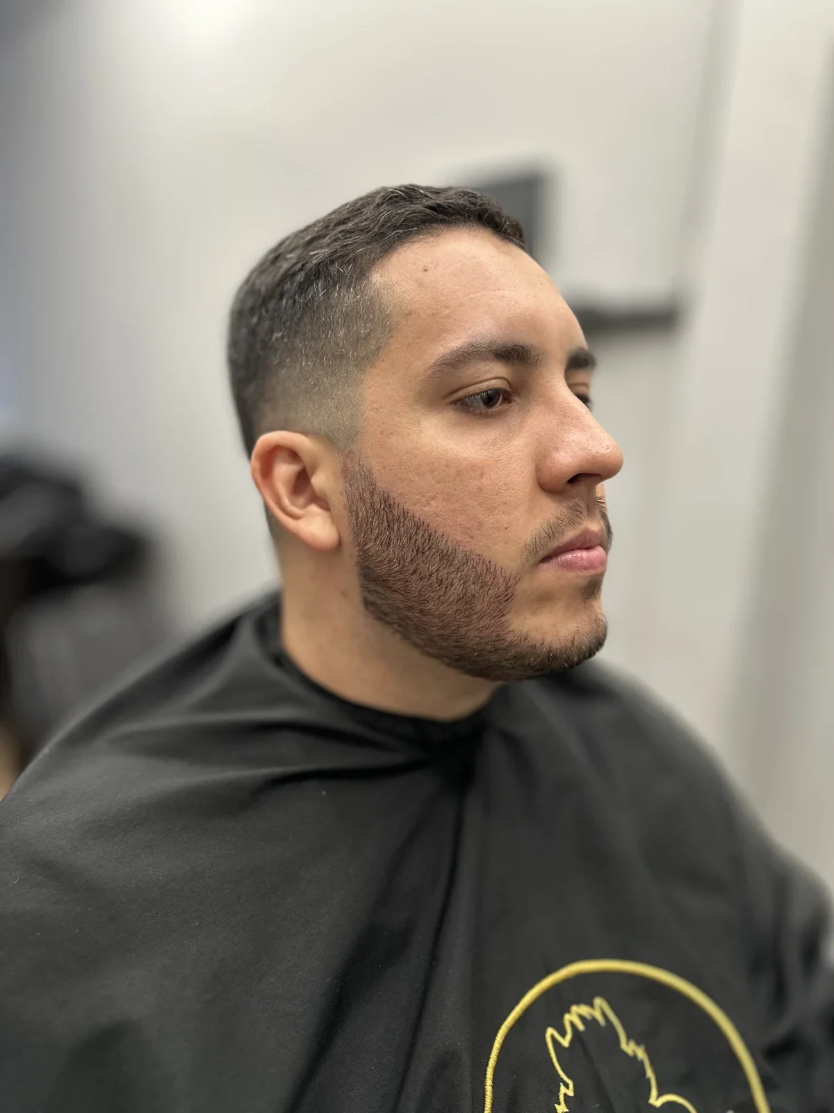 Depois da micropigmentação de barba