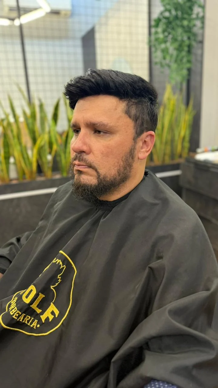 Antes da micropigmentação de barba