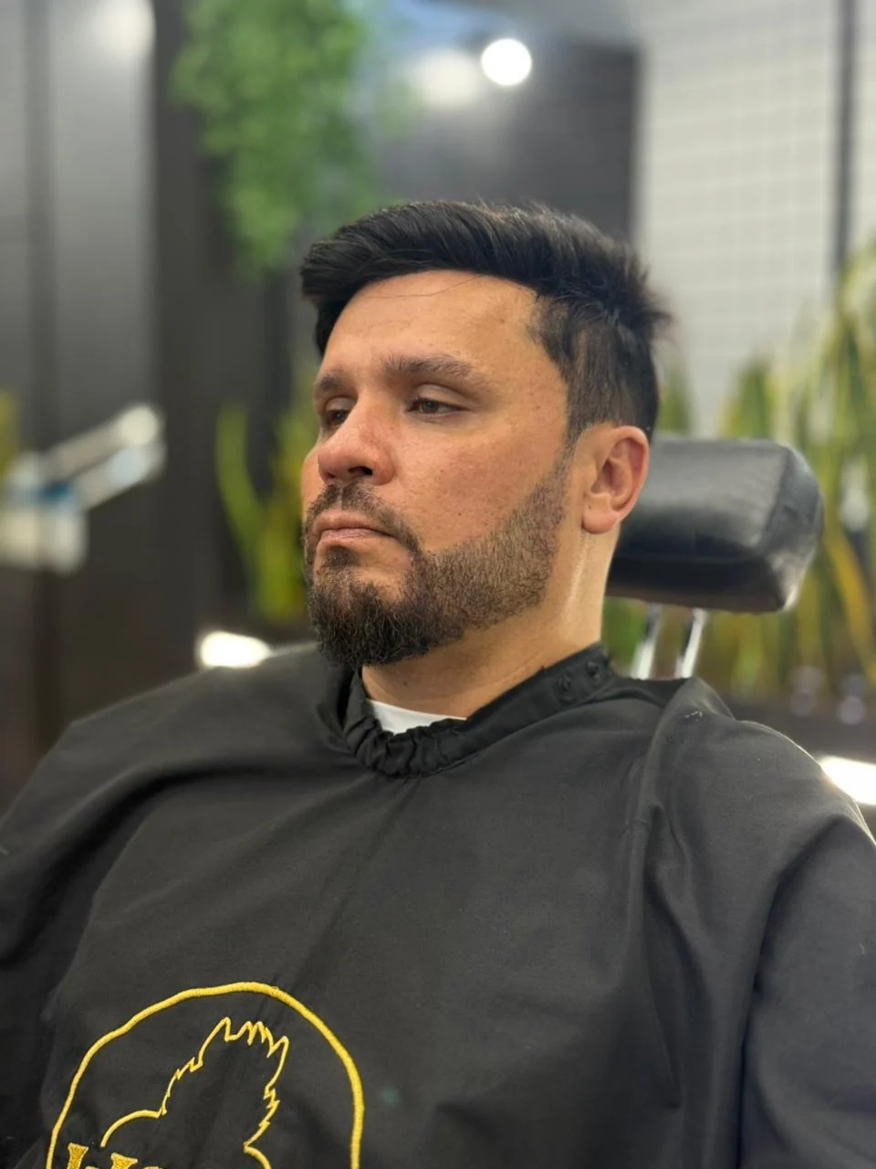 Depois da micropigmentação de barba