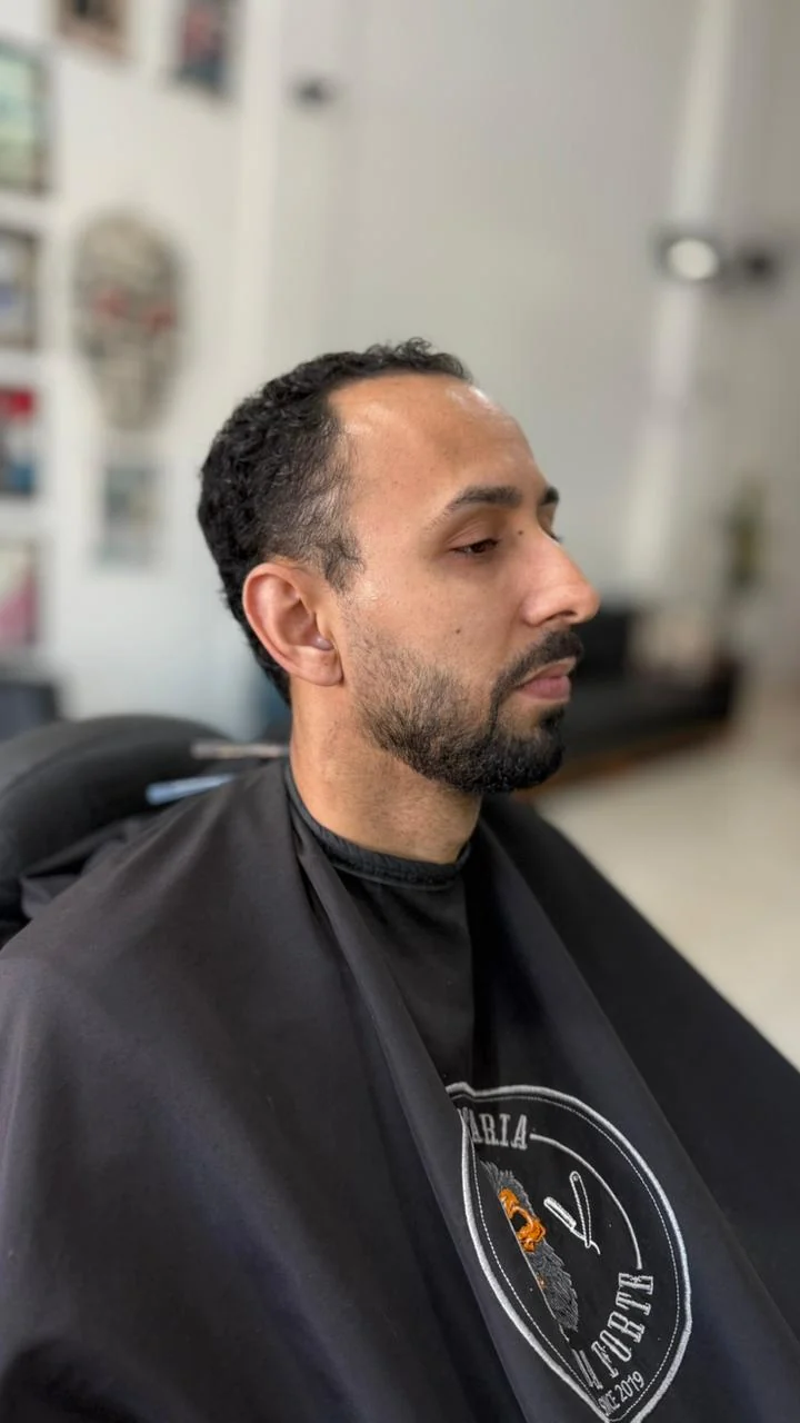 Antes da micropigmentação de barba