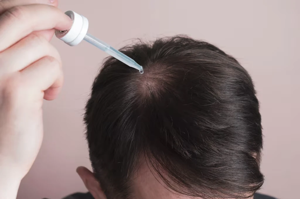 Homem observando falhas e rarefação capilar